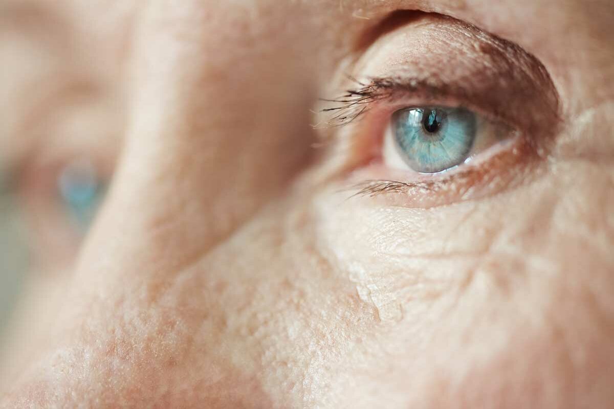 Cataracte chez la personne âgée : tout savoir